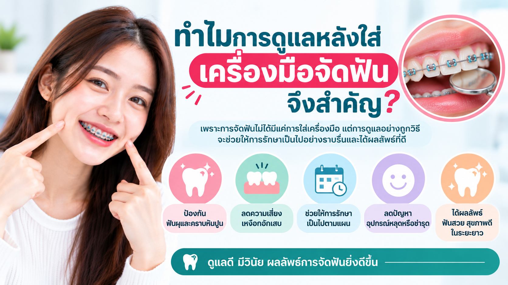 การดูแลตัวเองหลังใส่เครื่องมือจัดฟัน