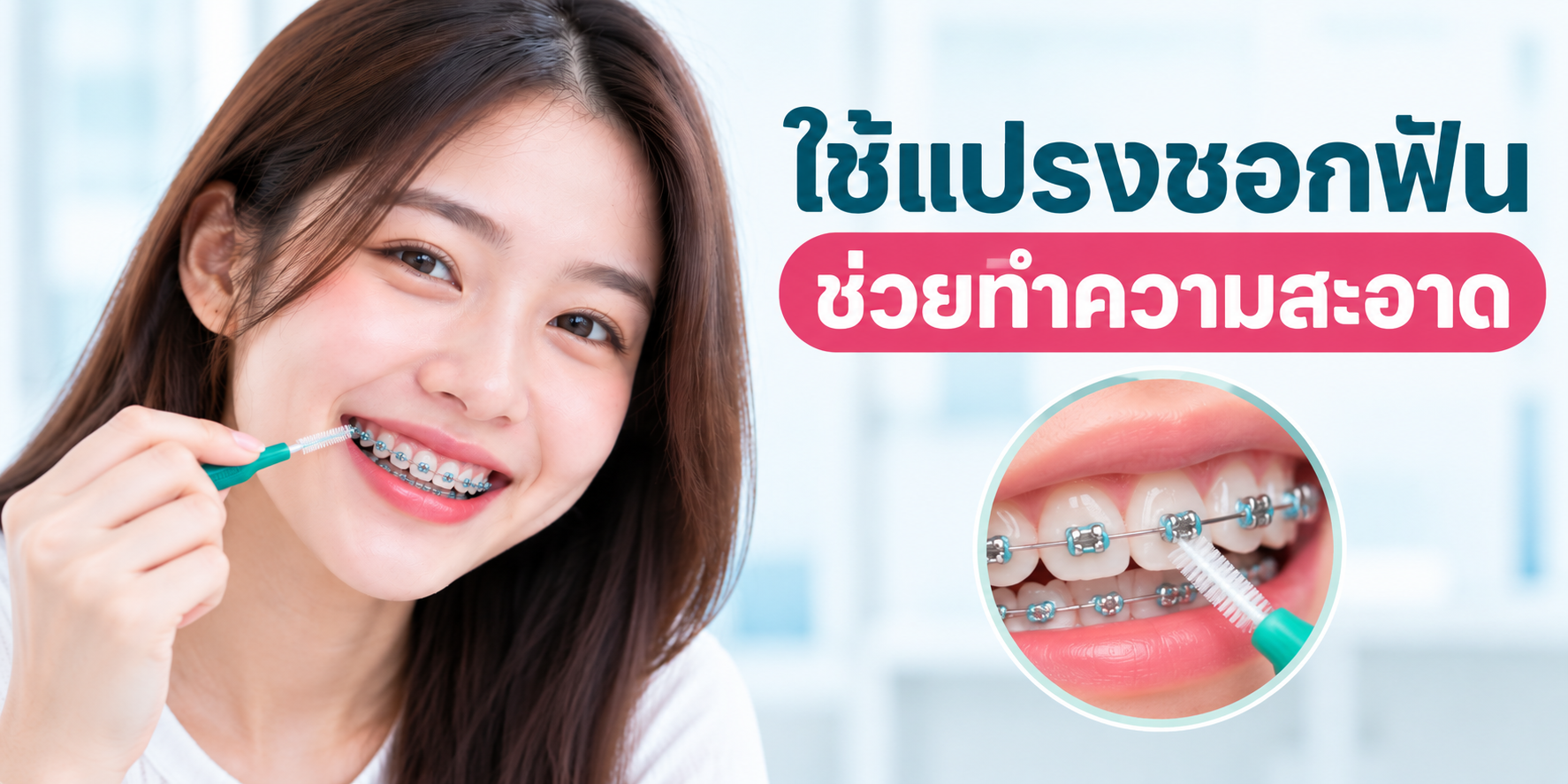 จัดฟันเชียงใหม่ ที่ไหนดี