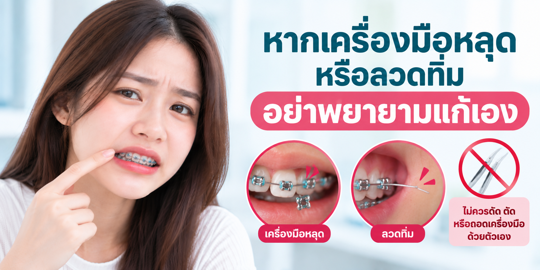 ข้อปฏิบัติหลังใส่เครื่องมือจัดฟัน