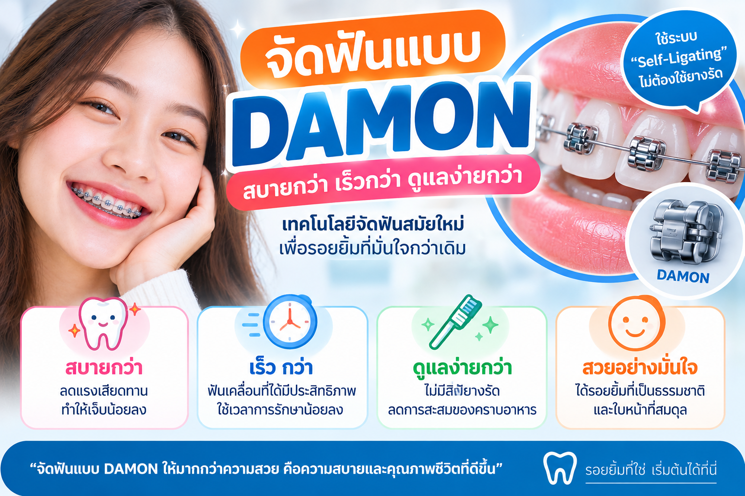 การจัดฟัน แบบ DAMON โดย คลินิกจัดฟันเชียงใหม่