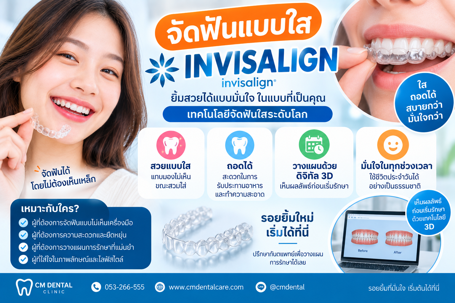 การจัดฟัน แบบ INVISALIGN โดย คลินิกจัดฟันเชียงใหม่